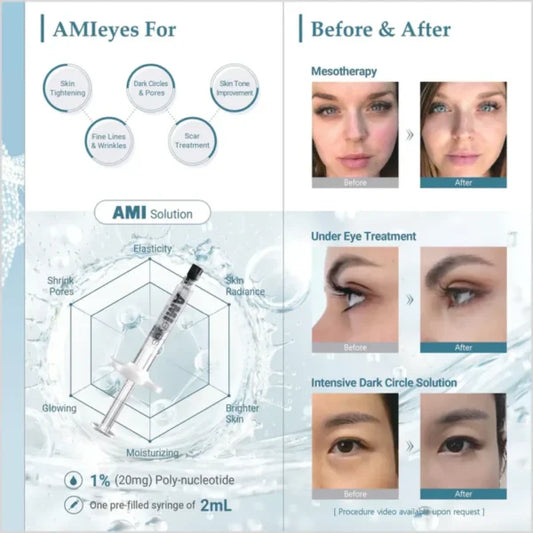 Ami Eyes Skin Booster (Polynucleotide)